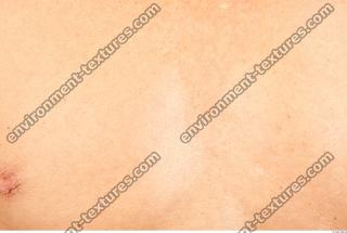 photo texture of white skin 0042